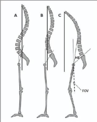 Spinal deformities