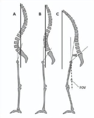 Spinal deformities
